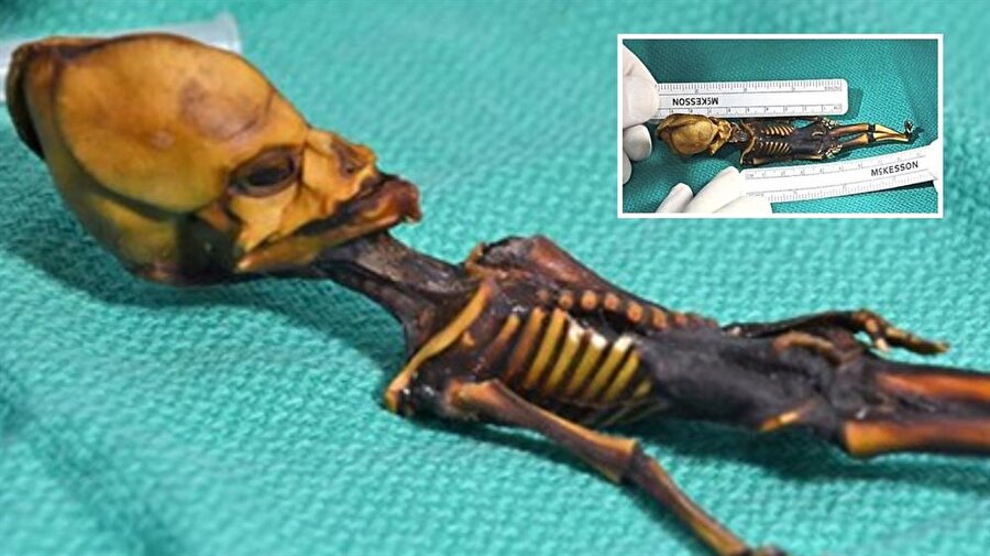 Ata, anomali ile doğan bir kız çocuğuna ait olduğu ortaya çıktı. ​