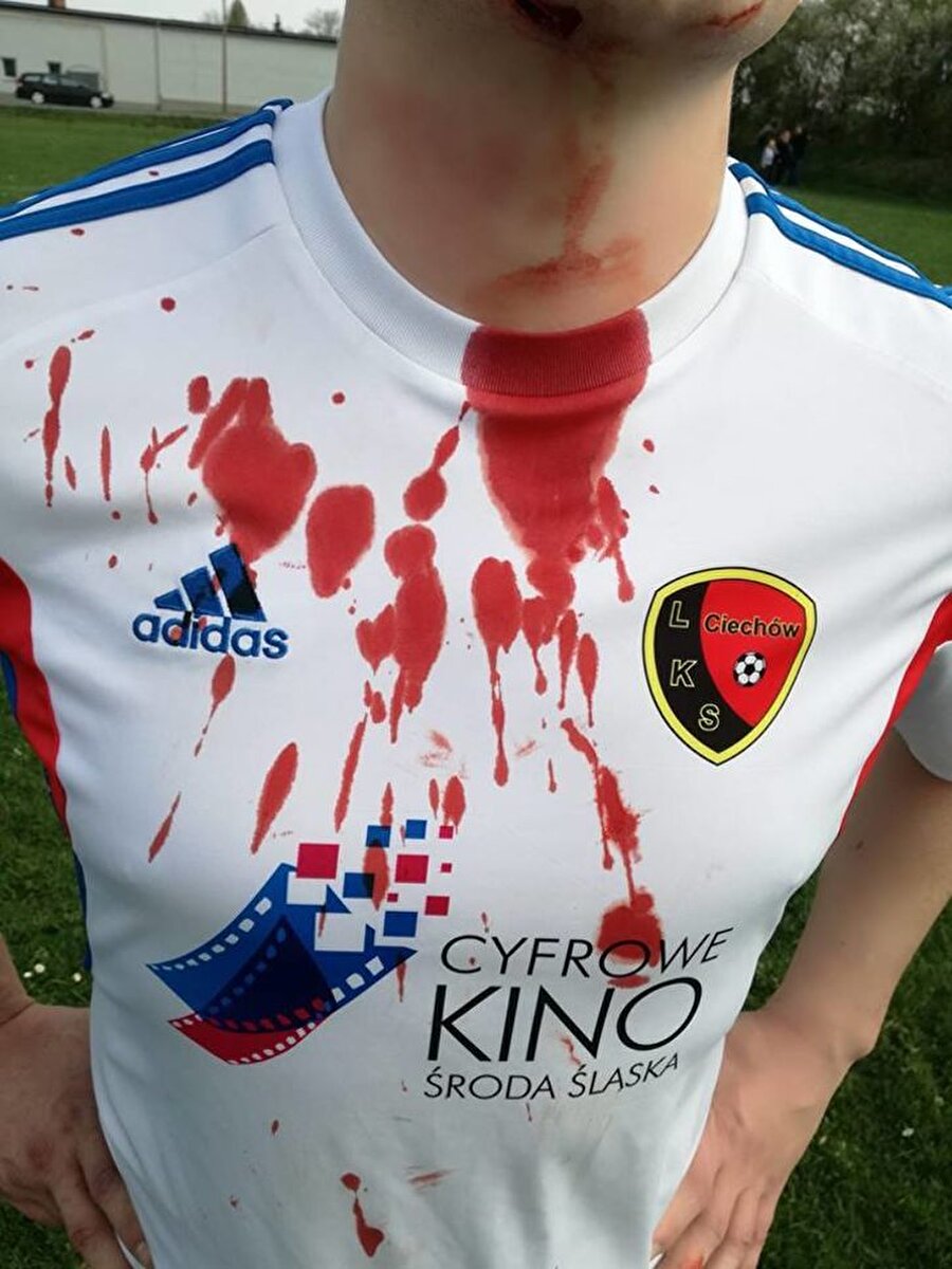 Futbolcunun forması böyle kan içinde kaldı...