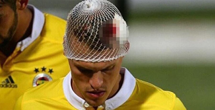 Martin Skrtel