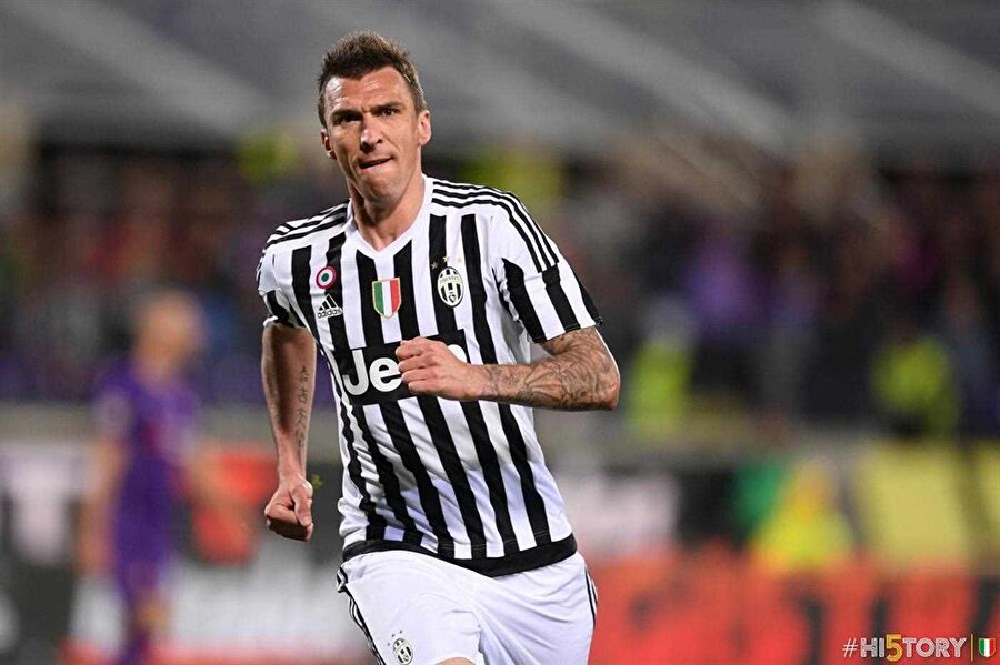 Mandzukic’in ayağı bu hale geldi
