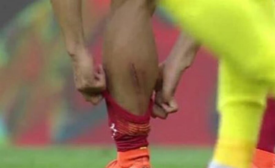 Yuto Nagatomo'nun görüntüsü sarı kırmızılı taraftarları endişelendirdi.