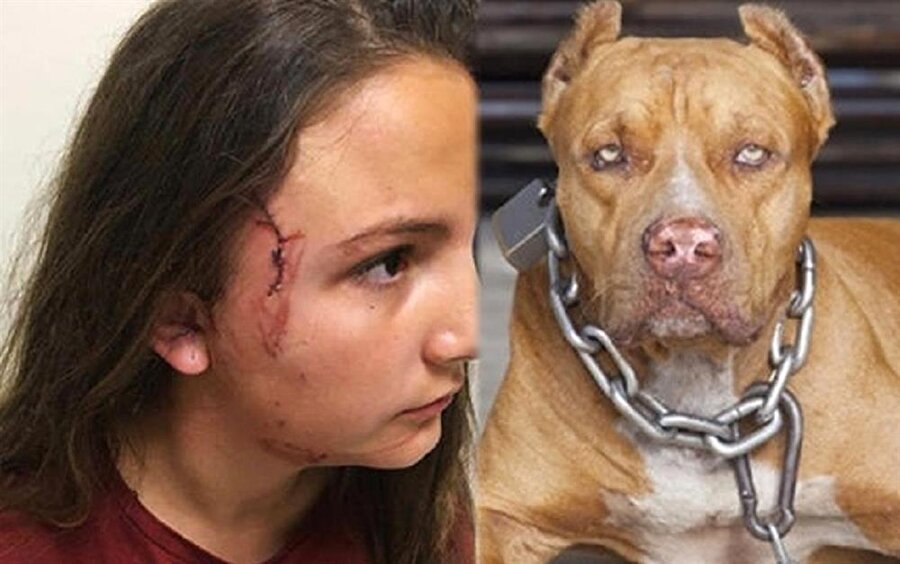12 yaşındaki İdil B. sahipsiz pitbul cinsi bir köpeğin saldırısına uğradı. 