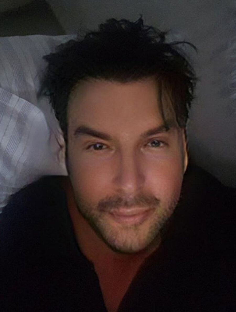 unlu sarkici burak ozcivit e benzemek icin ameliyat olacak