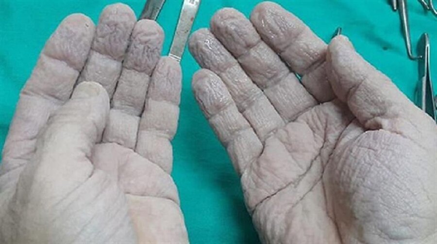 Ünlü doktorun elleri, sosyal medyanın gündemine oturdu