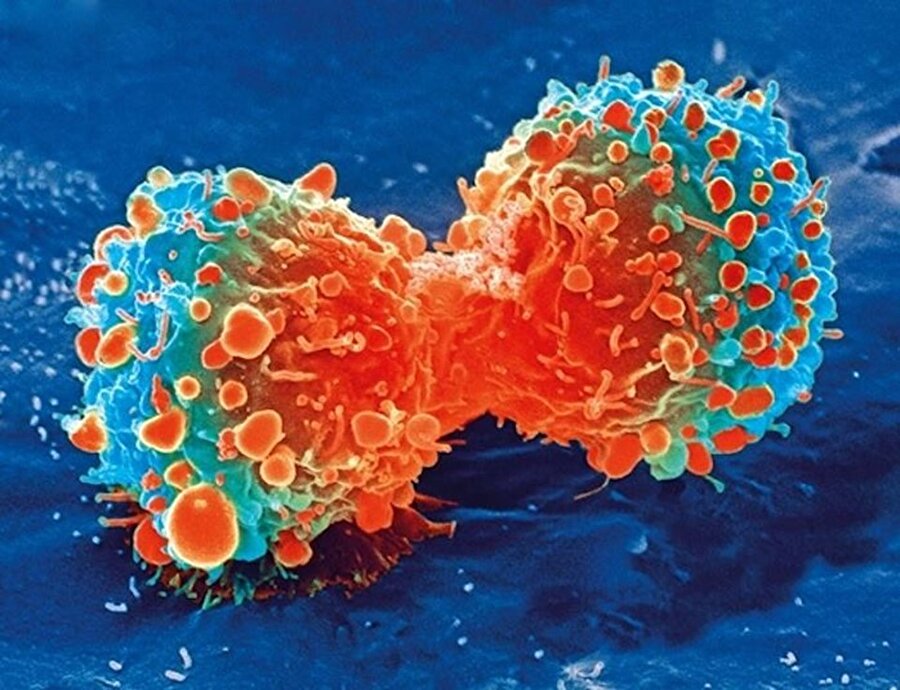 Kanserli hücrelerin büyüyüp ilerlemesini yavaşlatır.

                                    
                                    
                                    
                                
                                
                                