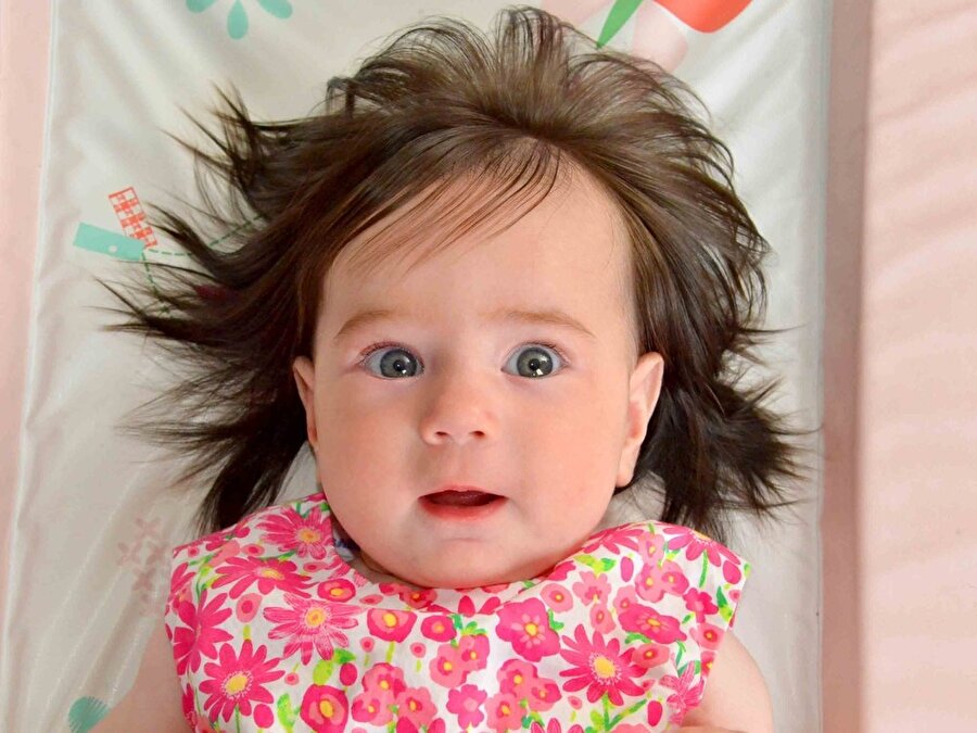 Saçları kendisinden hızlı büyüyor
Yeni doğan bebeklerde genellikle oldukça az saç bulunur; hatta dökülme bile yaşanabilir. Ancak Katherine'in saçları kendisinden hızlı büyüyor. Daha altı aylık olmasına rağmen annesinin söylediğine göre koyu siyah saçlarının uzunluğu 20 santime ulaştı bile. 