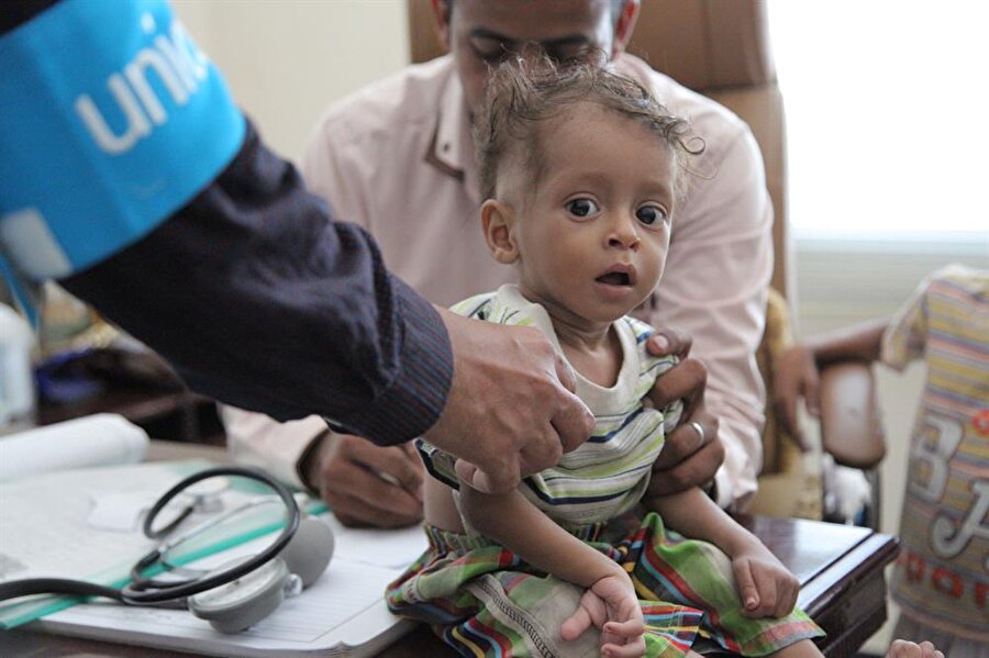 Suudi Arabistan'la İran'ın Yemen'de sürdürdüğü savaşın en büyük kurbanı çocuklar...