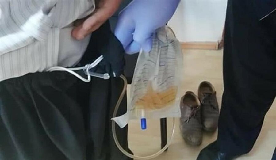 Dilencinin beline bağladığı serumdaki sıvının kola olduğu öğrenildi.