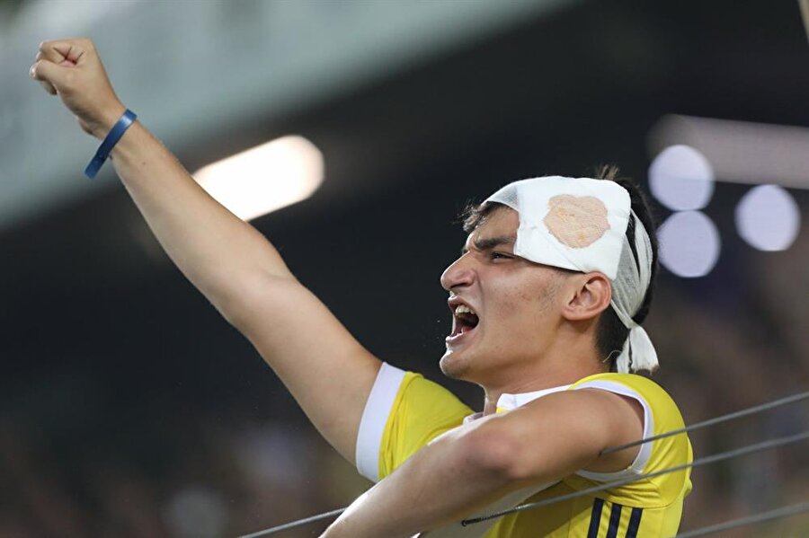 Fenerbahçeli bir taraftar, kafasındaki sargı beziyle tribünlerdeki yerini almış.