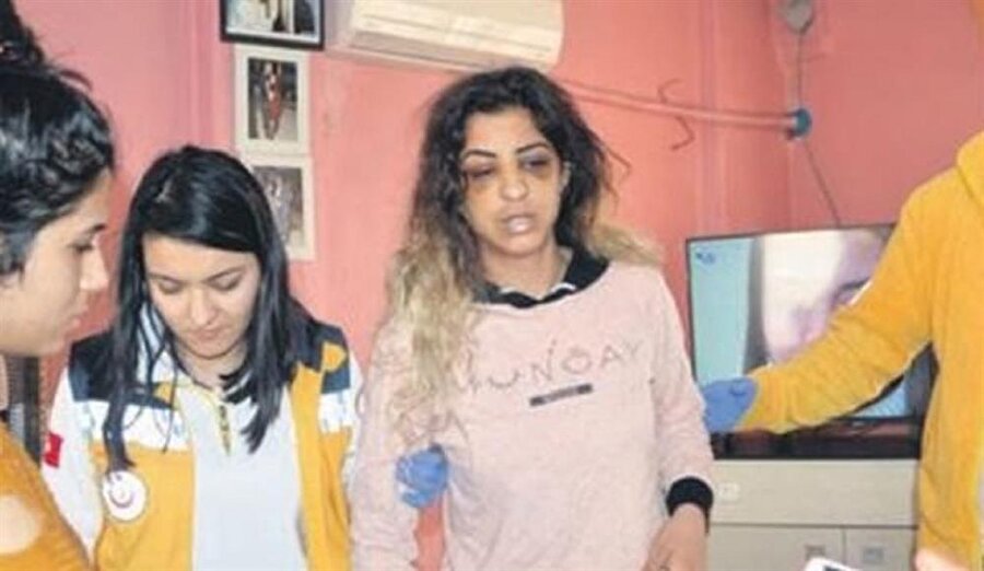 Şiddet gören kadın sağlık ekipleri tarafından tedavi edilmişti.