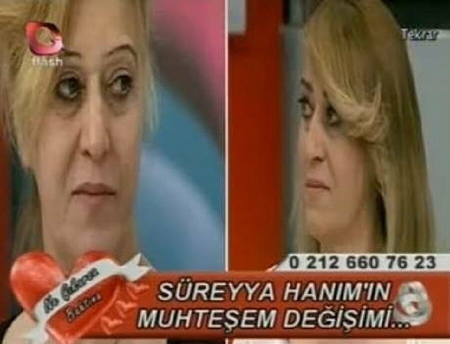 2017 ve 2018 arasındaki değişim