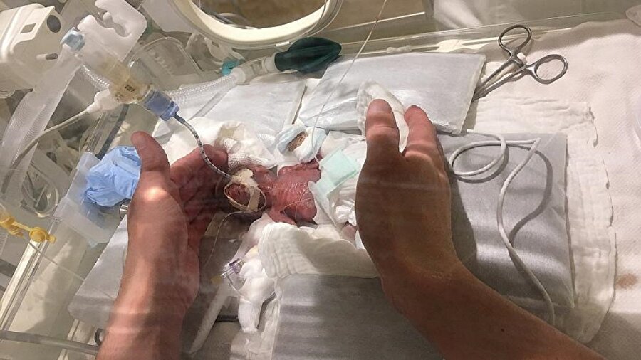Japon bebek 268 gram ağırlığında dünyaya geldi.
