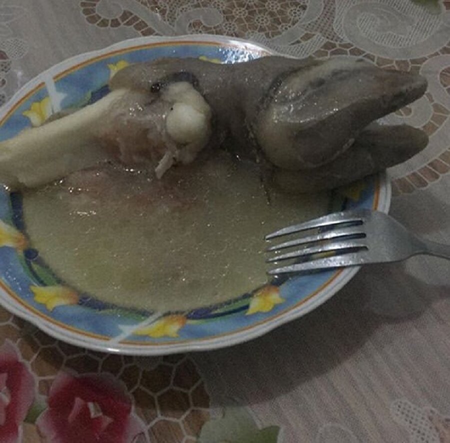 Midemi aldırdıktan sonra yiyebilirim​