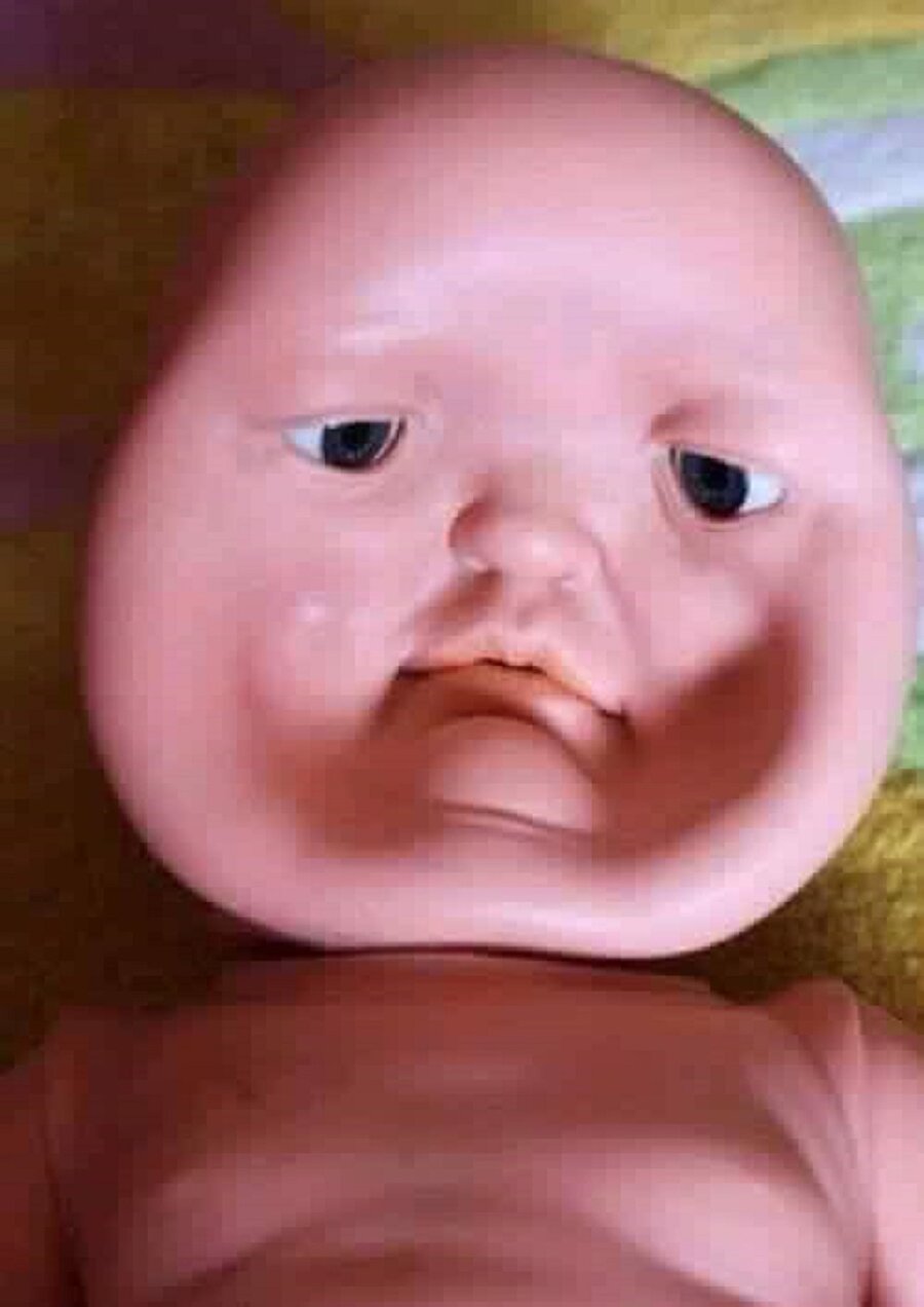 ​Kulağına üfleyin düzelir