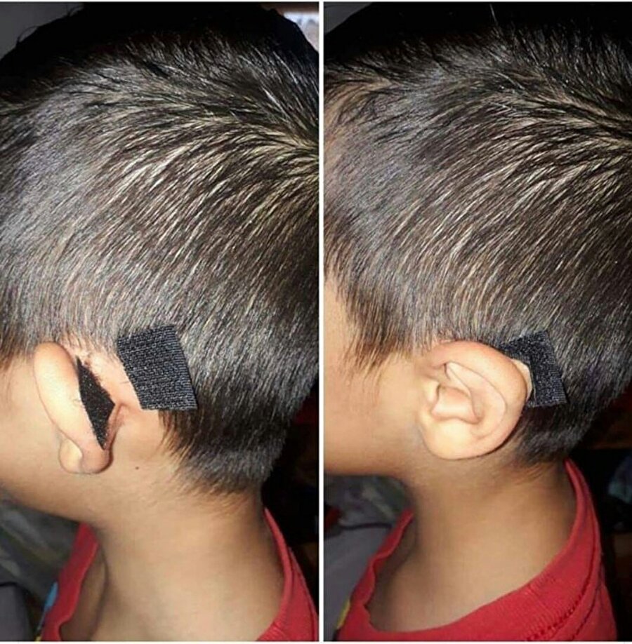 ​Sorunlarıma ürettiğim çözümler