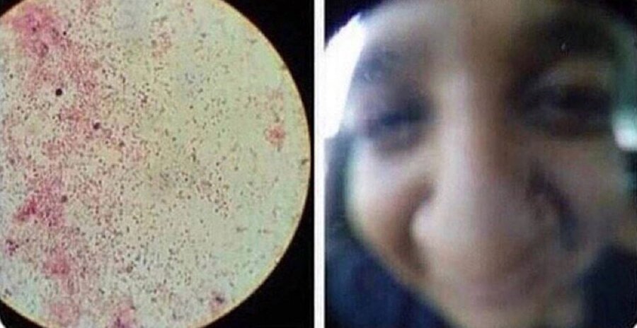 Bizim gördüğümüz / Bakterilerin gördüğü