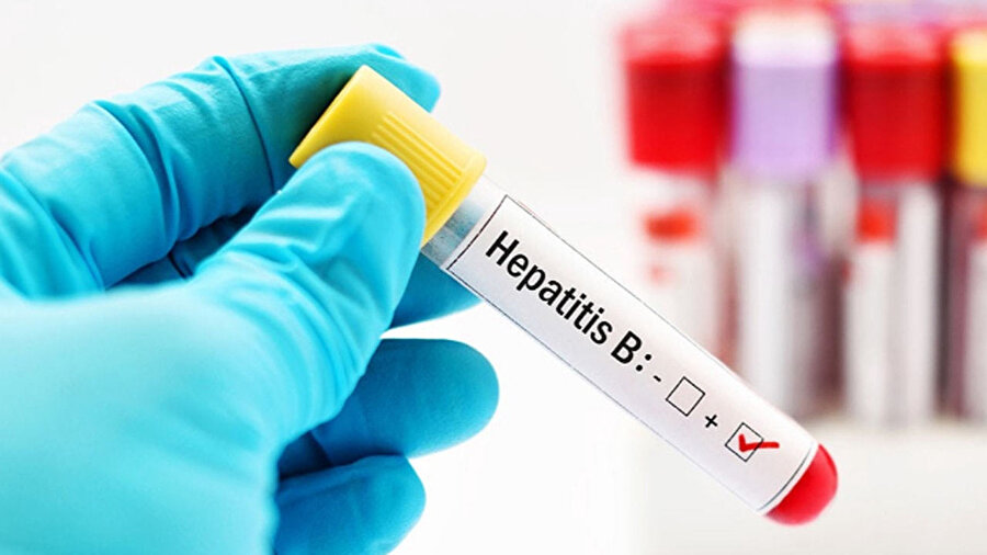 Türkiye'nin Hepatit B karnesi korkutuyor.