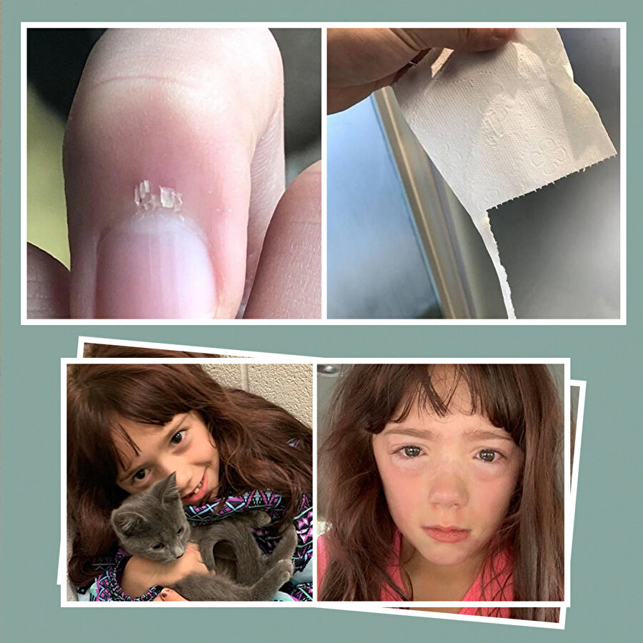 Gördüğünüz anda size acı verecek 15 talihsiz olay