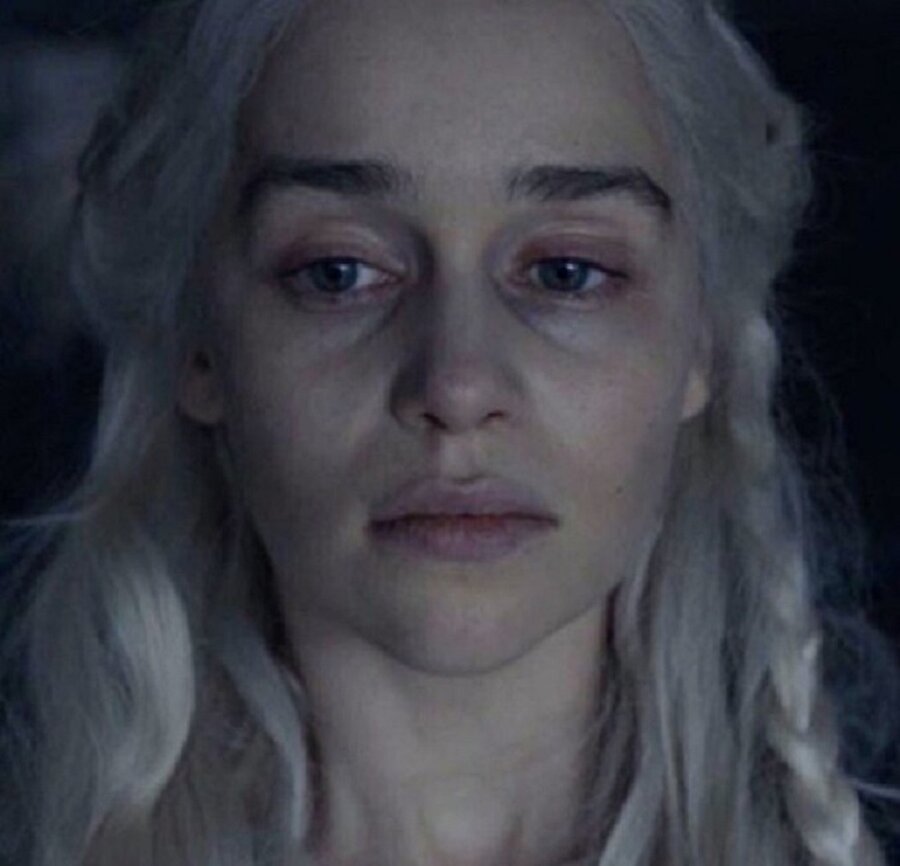 Hayır hasta değilim, sadece makyaj yapmadım