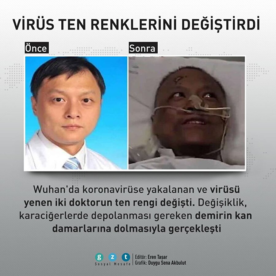 Koronavirüse yakalanan Çinli doktorların ten rengi değişti
