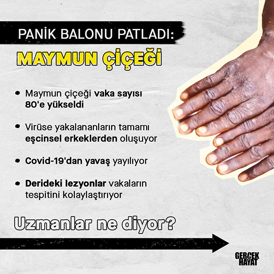 Maymun çiçeği gerçekleri ortaya çıktı