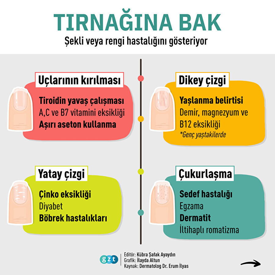 Tırnağına bak, sağlığını öğren👈🏻