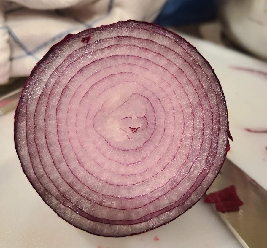 Bir gülüşü var ağlarsın