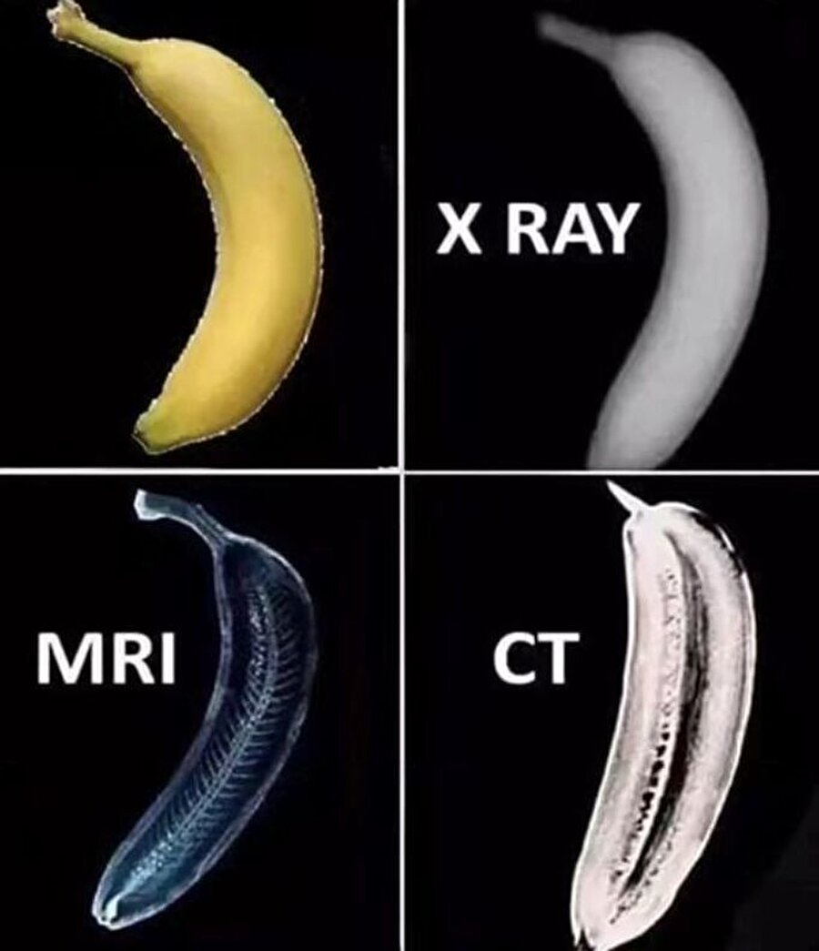 Muzun türlü türlü hâli