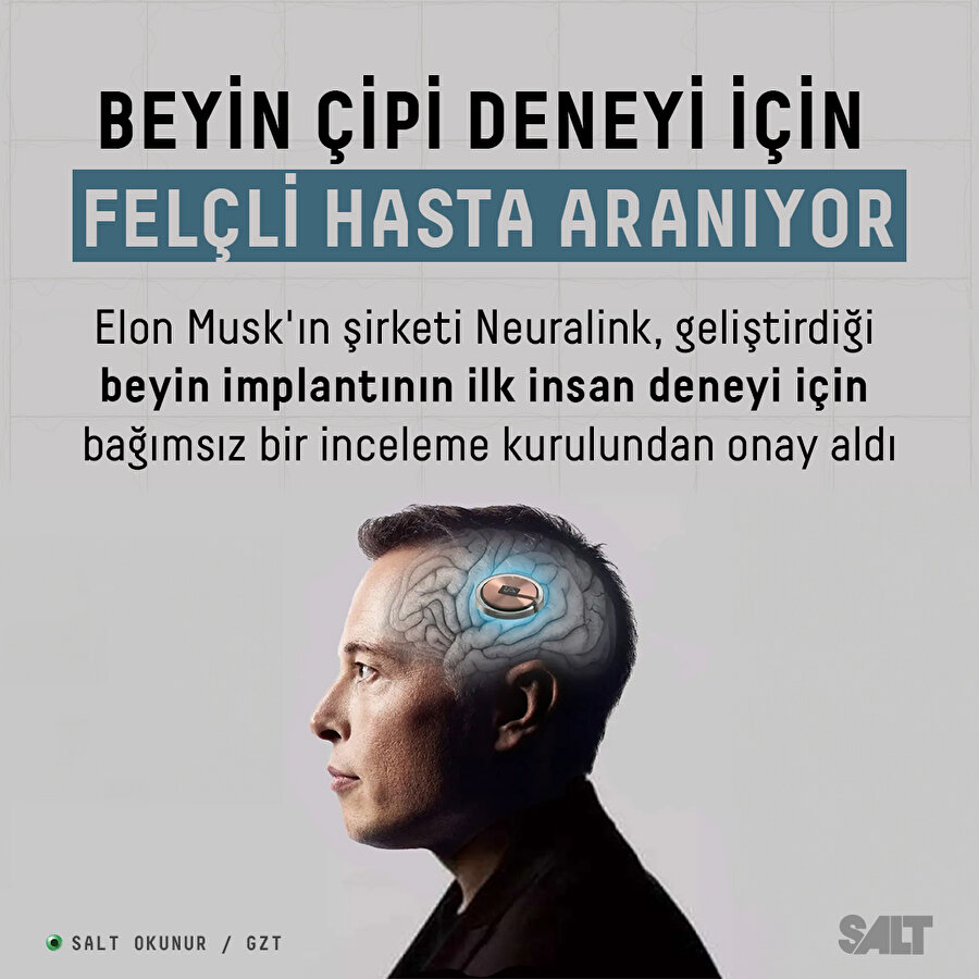 Beyin implantı için felçli hasta aranıyor