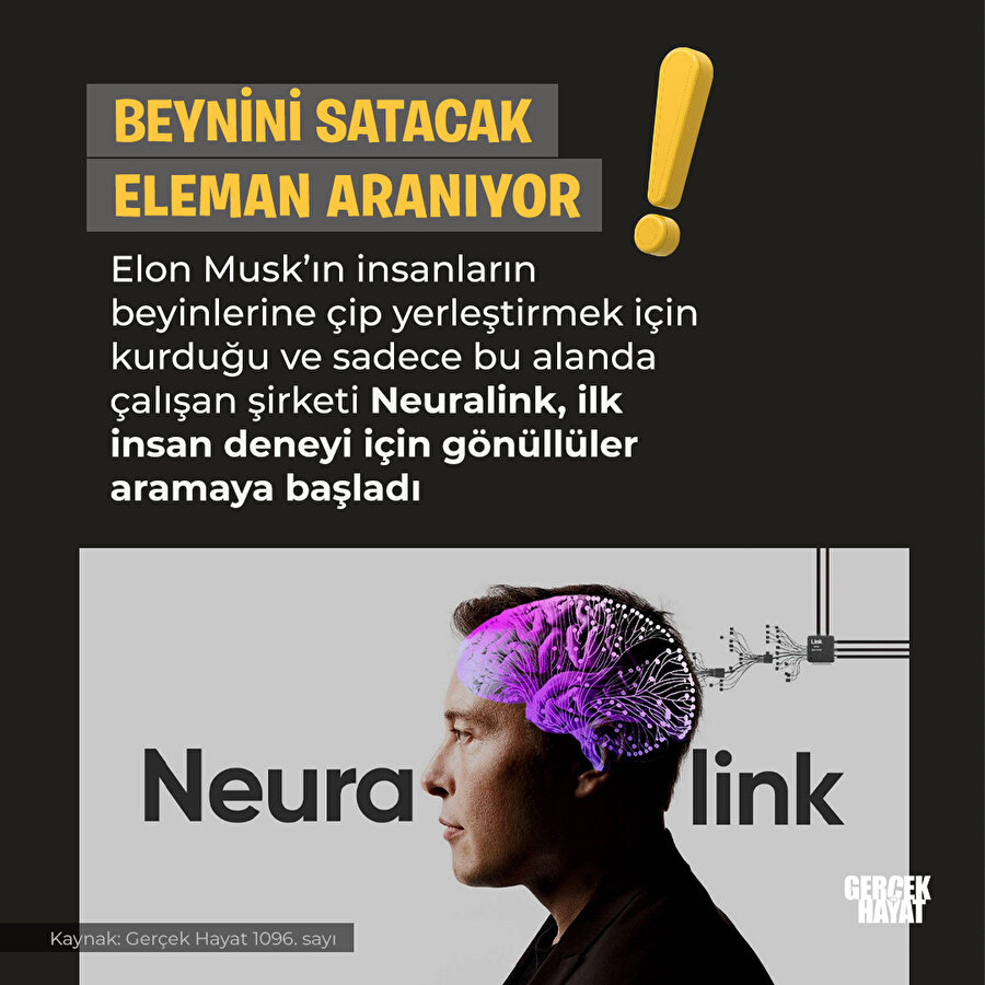 Elon Musk deney için satılık beyin arıyor