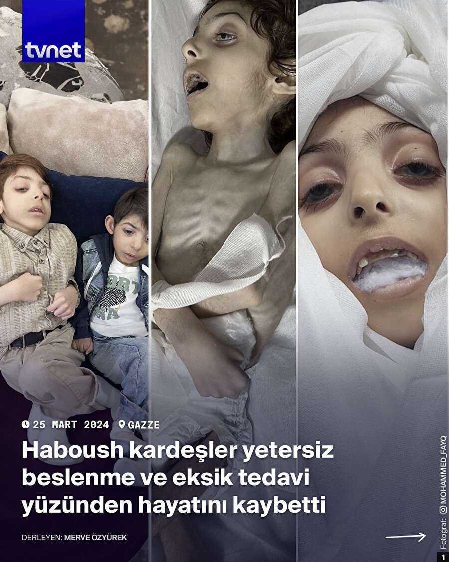 Son bulmuyor, Gazzeli çocuklar açlıktan ölüyor