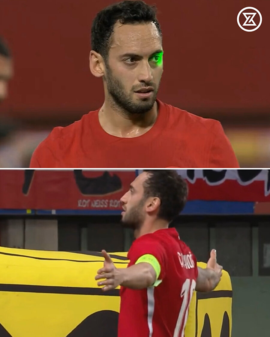 Gözüne lazer tutuldu, golünü attı ve böyle sevindi!
