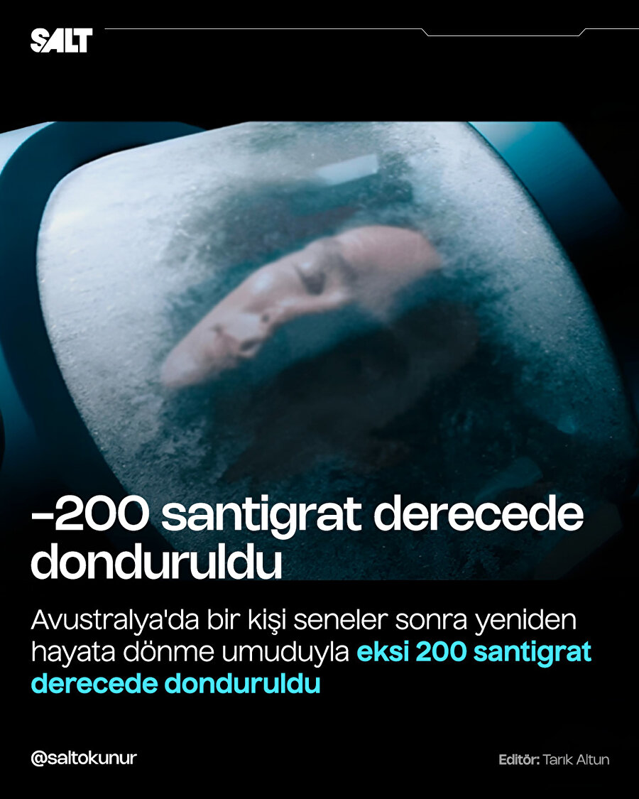 Yeniden hayata dönme umuduyla eksi 200 santigrat derecede donduruldu