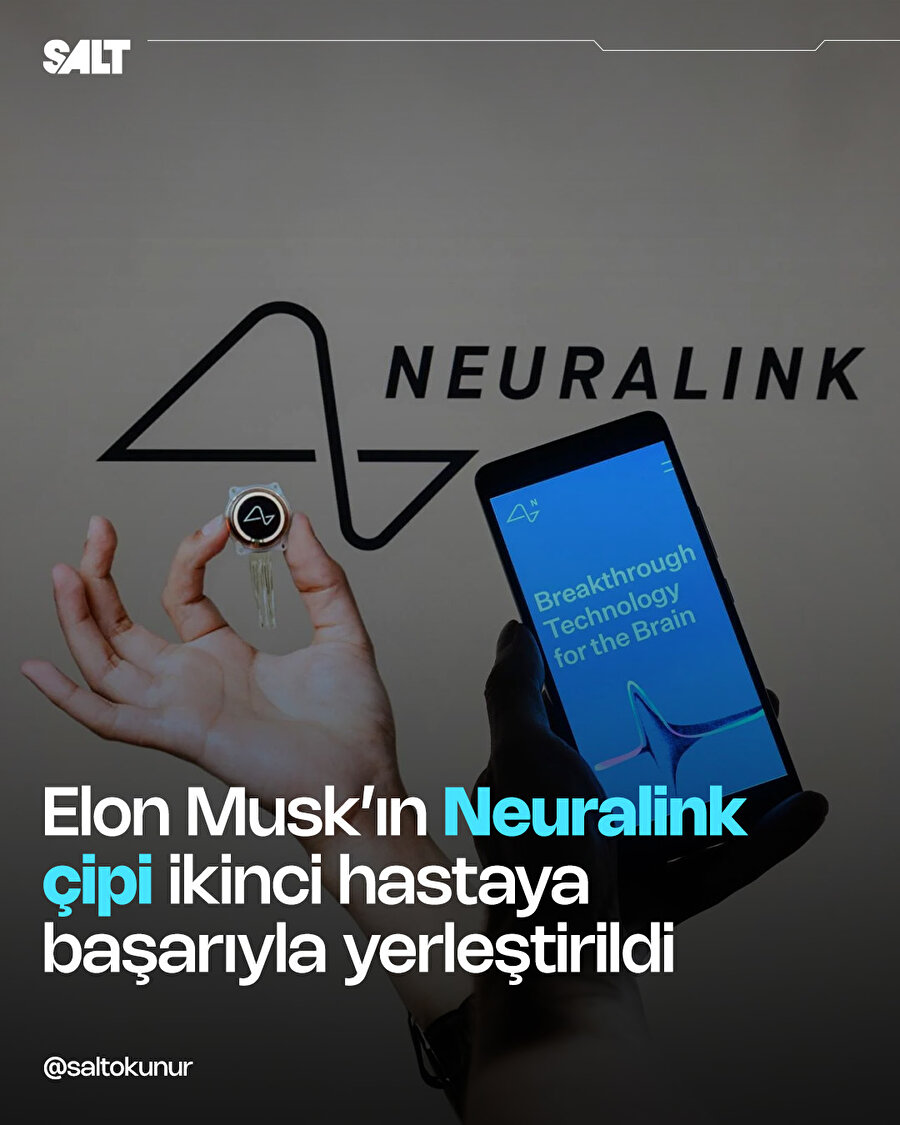 Neuralink çipi ikinci kez başarıyla yerleştirildi