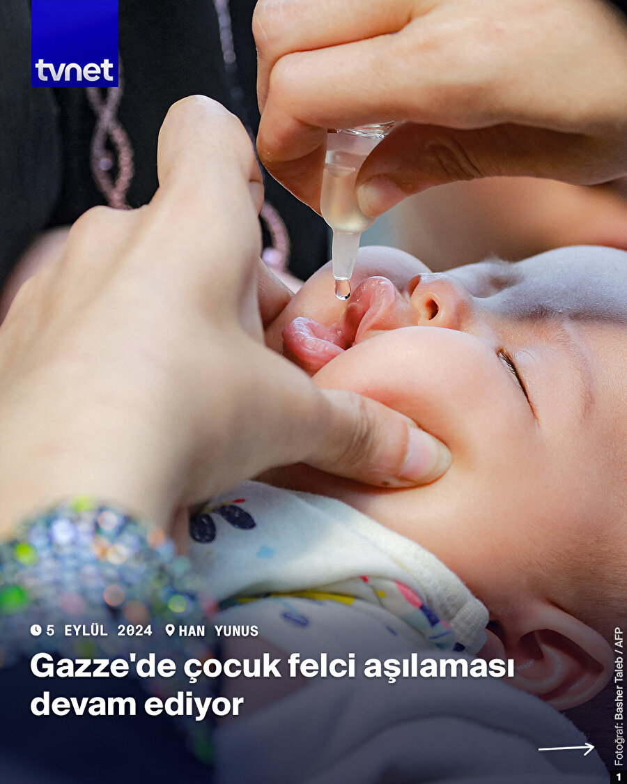Gazze Şeridi'nde çocuk felcine karşı mücadele