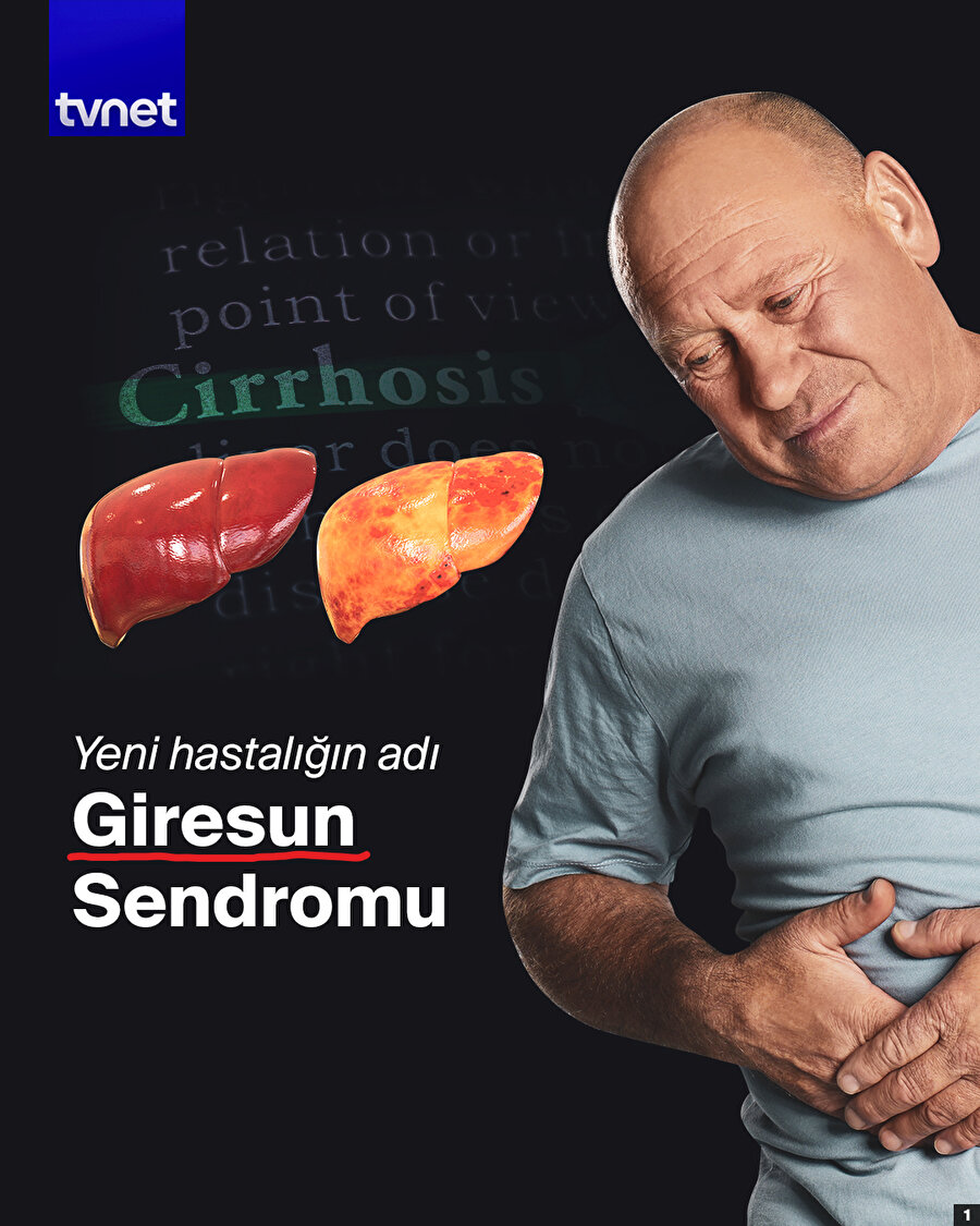 Yeni hastalığın adı Giresun Sendromu