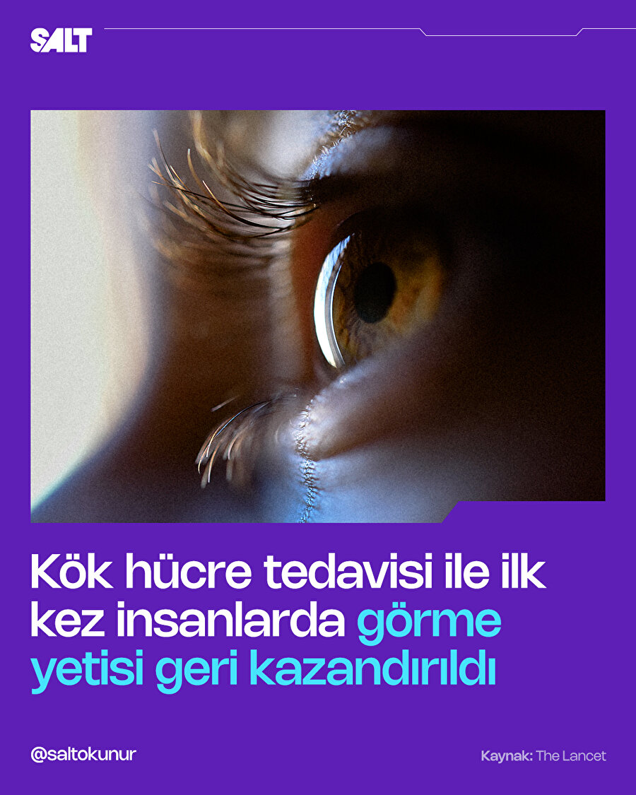 Körlük kök hücre ile düzeltilebilir