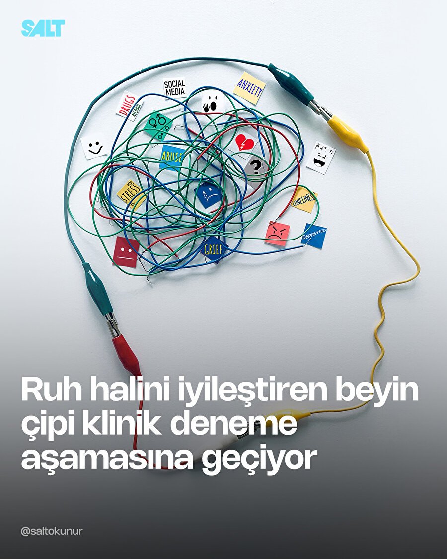 Ruh hali düzenleyen beyin çipi