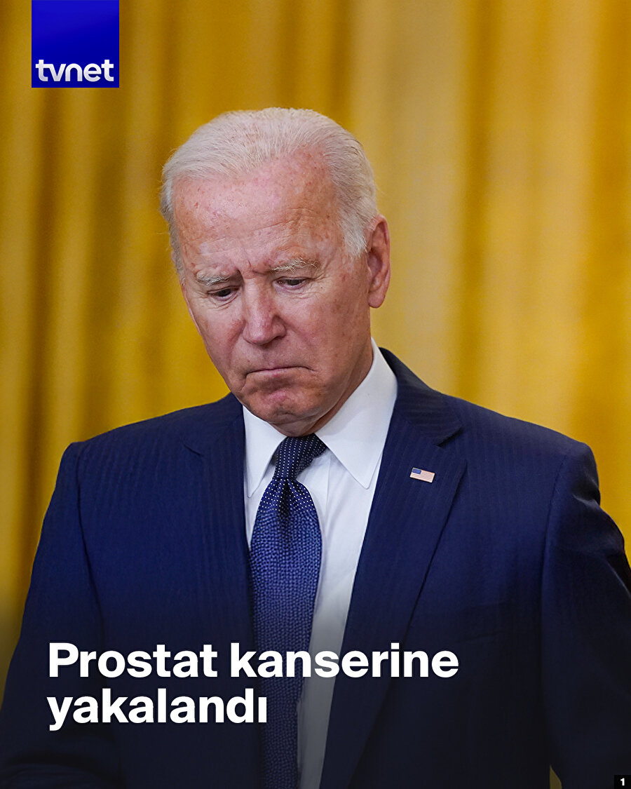 Prostat kanseriyle mücadele edecek