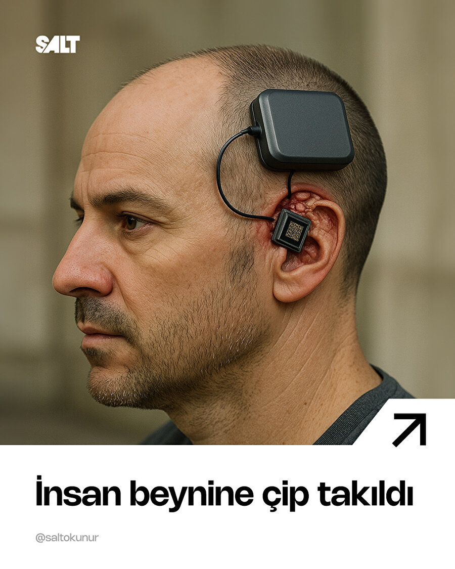 İnsan beynine çip takıldı