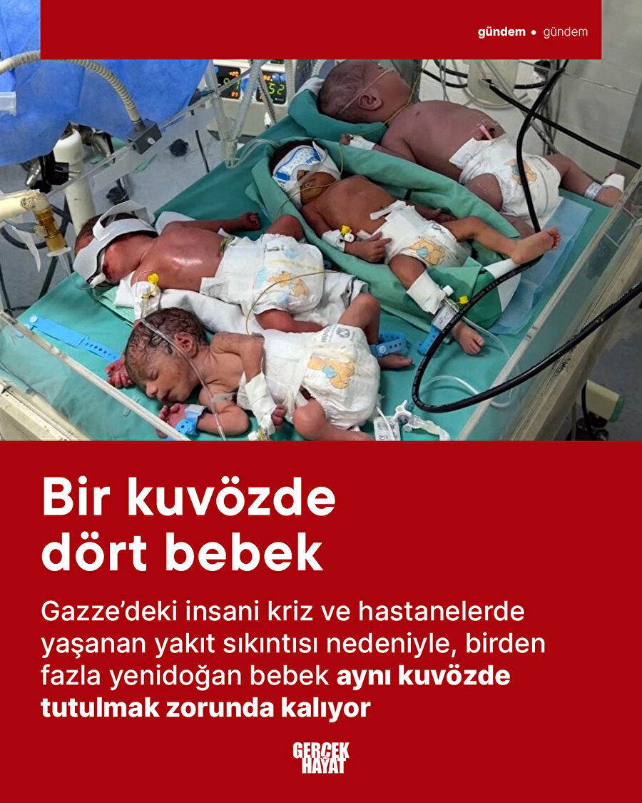 Bir kuvözde dört bebek