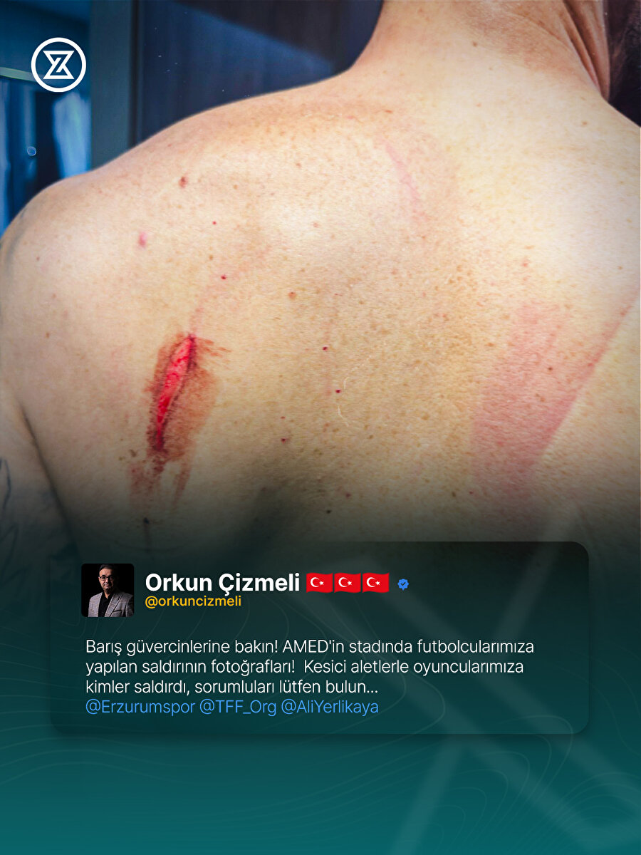 Amedspor-Erzurumspor maçından sonra ortalık karıştı