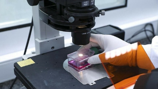 UK health authority advises self-isolation for monkeypox infections