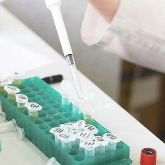 Lebanon reports 1st case of monkeypox