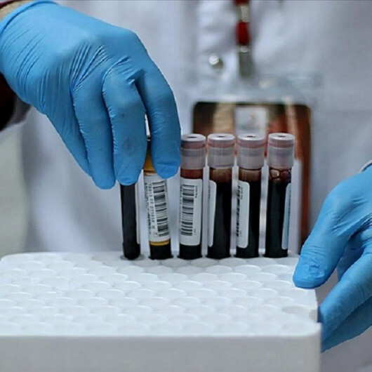 UK researchers change blood type of donor kidneys