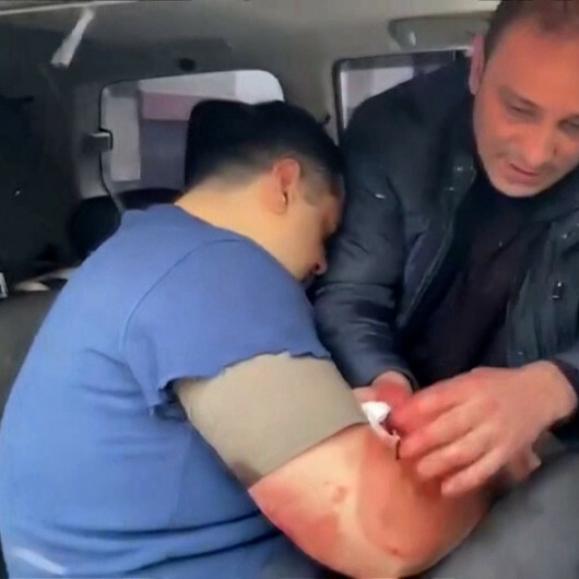 Azerbaycan’ın İran elçiliğine silahlı saldırı
