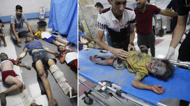 İşgalci İsrail saldırılarında çok sayıda kişi yaralandı. 