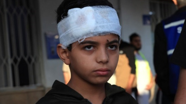 Un enfant Palestinien blessé suite aux attaques israéliennes, dans le sud de la bande de Gaza, le 20 octobre 2023. Crédit photo: SAID KHATIB / AFP