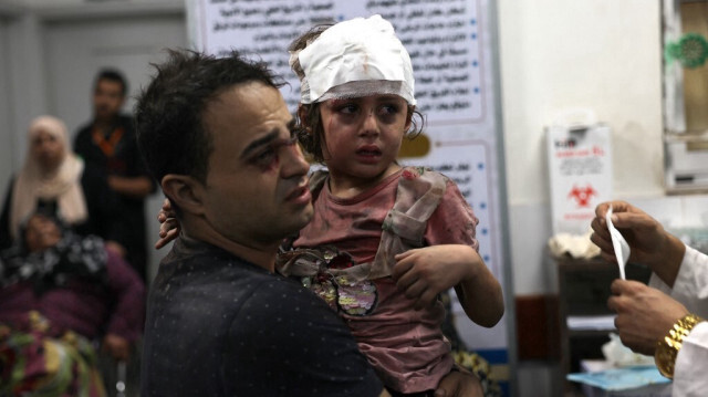 Un Palestinien porte sa fille gravement blessée à l'hôpital de Najjar, suite à une frappe aérienne israélienne sur une maison à Rafah, à Gaza, le 30 octobre 2023. Crédit photo: SAID KHATIB / AFP
