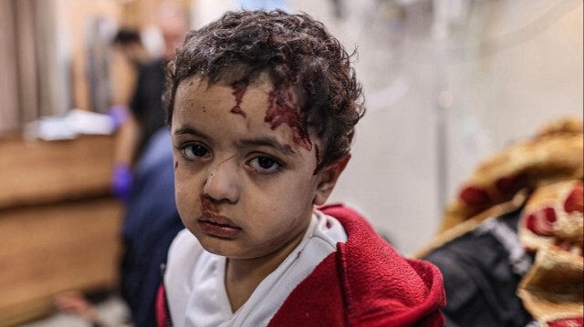 Des enfants, sont soignés à l'hôpital Nasser alors que les attaques israéliennes se poursuivent Gaza, le 21 novembre 2023. Crédit photo: AA